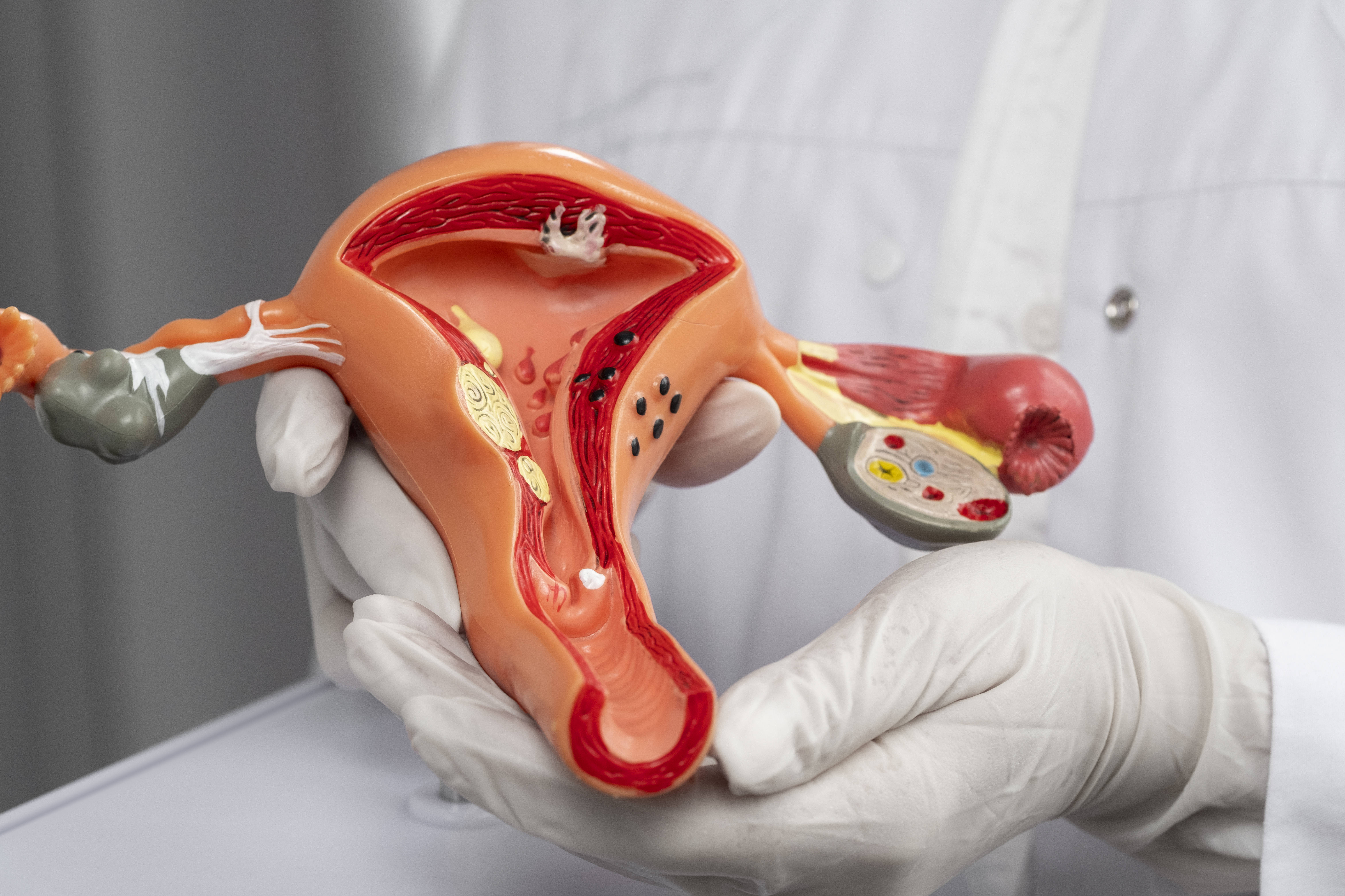 IUI Treatment
